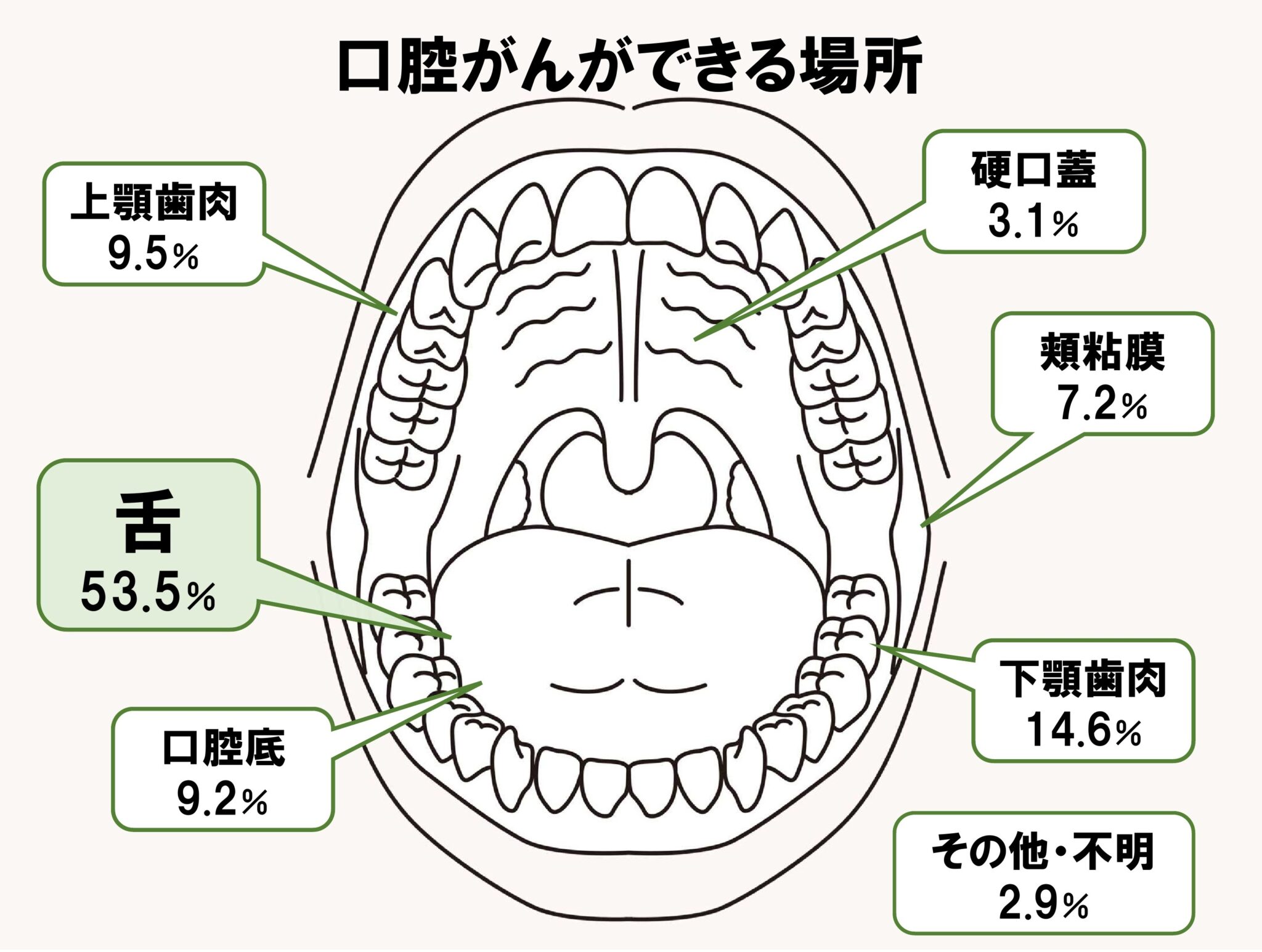 口腔がんになりやすい人